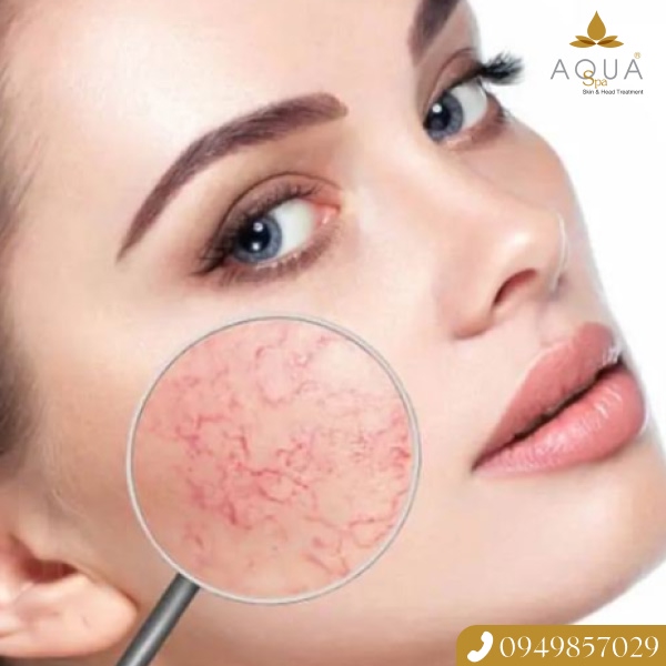 Nano Miracle Treatment Enhances Collagen Production, Fades Wrinkles to Help Skin Bright and Smooth