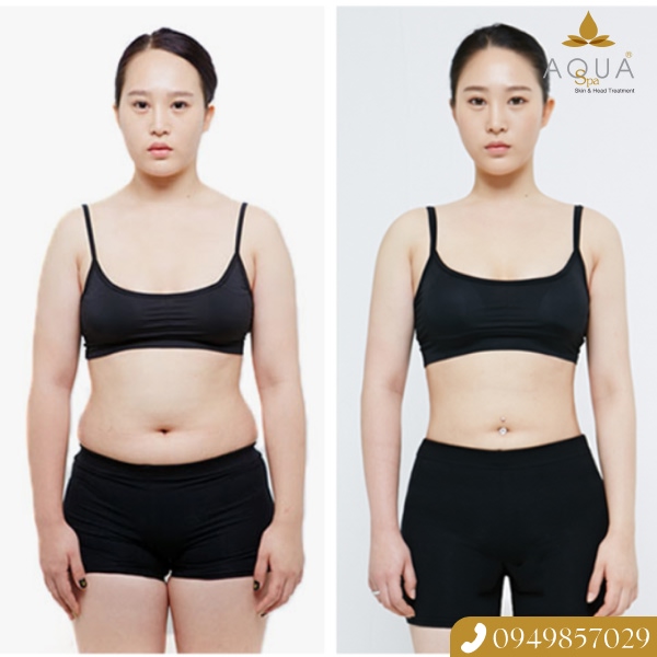 Trải Nghiệm Thon Gọn Toàn Thân Chuẩn Pháp Với Liệu Trình Guinot Tại AQUA SPA